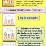 Tukang Gigi Terdekat: Solusi Cepat untuk Masalah Gigi Anda